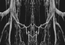 ZATOKREV – Zatokrev